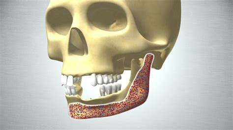  ニチロドネ: 骨の再生に革命をもたらす！その驚異的な特性とは？